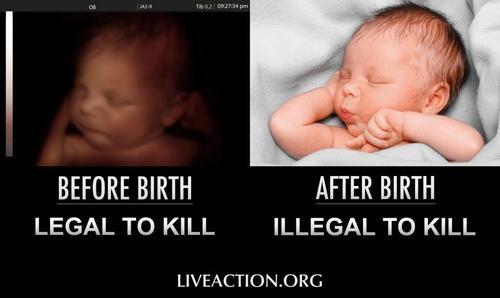 rednet72's tweet photo. Yes I am pro choice, I choose not to kill! Pro Life is the ONLY choice http://t.co/FQ3769D8