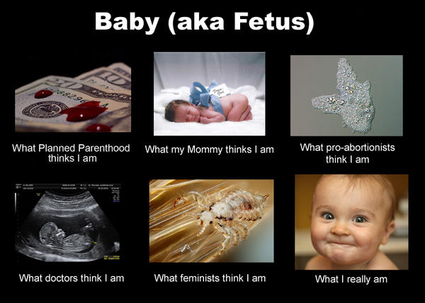 abolish human abortion am i not human graphic abolish human abortion am i not human graphic