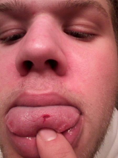 cody__blake's tweet photo. Just a little whole in my tongue.. #no biggy http://t.co/XV19Cv7k