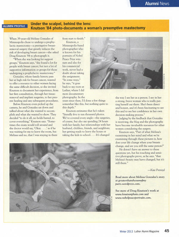 DAKnutson's tweet photo. Documenting a friend’s prophylactic #mastectomy has been a very special story to tell. Here in an article about it- http://t.co/DOVGUGQ6