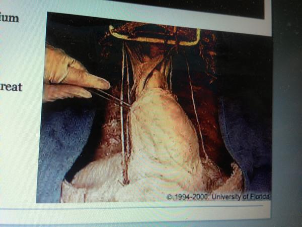 SirZiggyRevere's tweet image. Condition my heart will be in follow this exam..... #gradschoolproblems #developmentalbio #killerexam