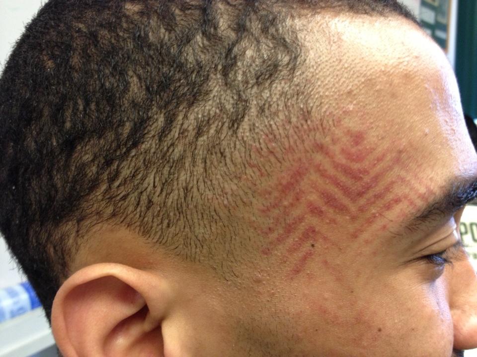 Cal-Poly b-ball player gets 'shoe print tattoo' after teammate steps on his face (Photo)