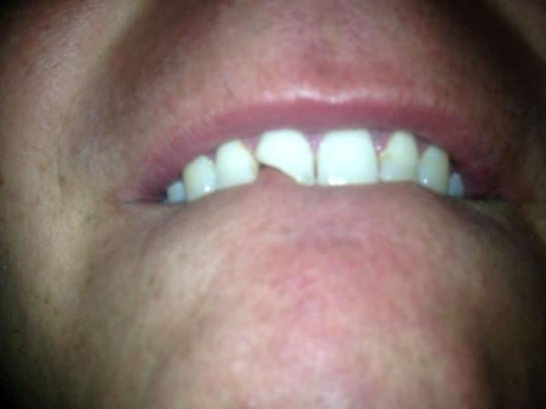 tonopanzas's tweet photo. @gracenaya y checa como me dejo http://t.co/wR9BOvl9