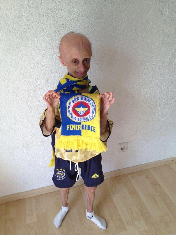 fenerkolikorg's tweet photo. Onun ismi Gamze ve o cok hasta

ALLAH SANA SIFALAR VERSIN ! AMİN TümHaksızlıklara Karşı DirenmeninAdıdır FENERBAHÇE http://t.co/6FTnNf7F