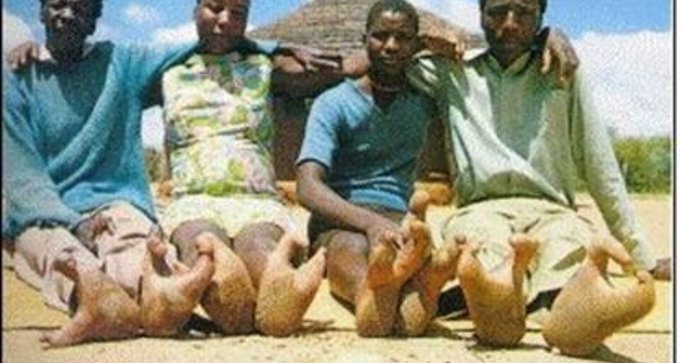 This is the result when a tribe law forbids you to marry outside the tribe! #vadomatribe #ankdammen http://t<a href="/tag/vadomatribe"class="tags"><span>#vadomatribe</span></a><a href="/tag/ankdammen"class="tags"><span>#ankdammen</span></a>
