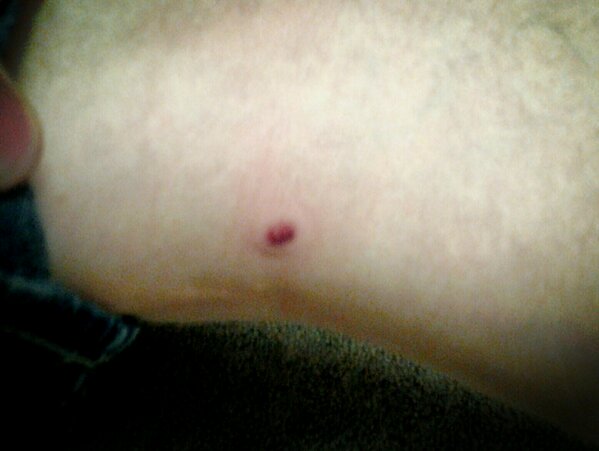AndrewIstace's tweet photo. #cordell ginnis bb gun bad idea he picked me of from two rooms away http://t.co/N7OQrLcu