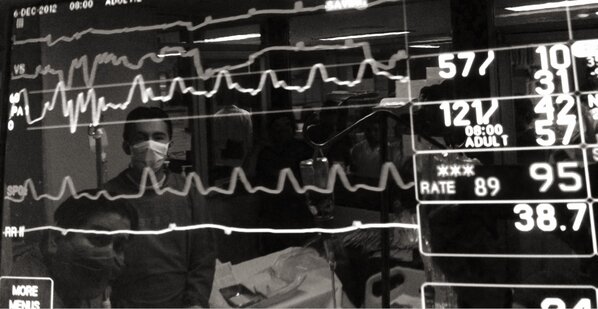doctorthierry's tweet photo. About :
https://t.co/qKwIv5J3
One RV trace, catheter whip and then PA trace
#ICUData http://t.co/m2ZiOP0v