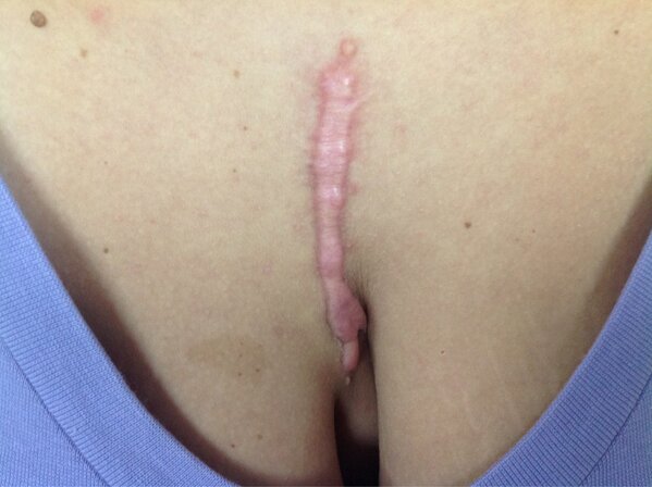 POCASHUELLAS's tweet photo. El día de Hoy atendiendo nuevos casos @doctoraldanag @aldanalaser http://t.co/qFA4CeIA