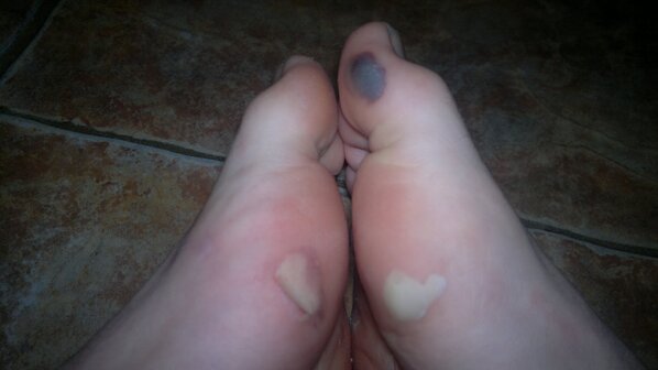 JordanCantwell's tweet image. Just got back. #BigSESH #BloodBlister #Blisters #PAIN #Cardio #Commitment