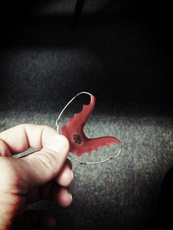 FabianWickham's tweet image. Is it gay that I have a paw print on my retainer? #NerdyFabian #RepYoTeam