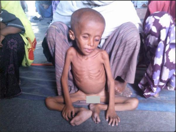 Twitter / GeorgieBC: A #Rohingya child from the ...