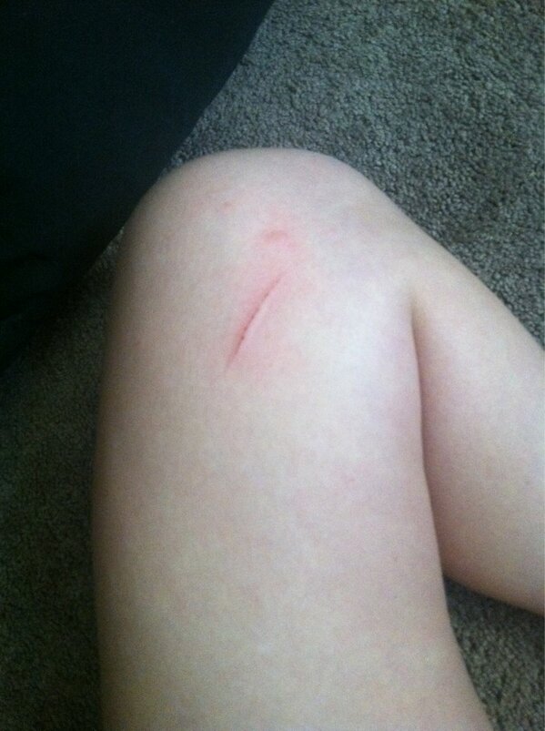 hayleejustine_'s tweet image. lets just talk about how my bed attacked me and I'm probably gonna bleed out and die. #notdramatic