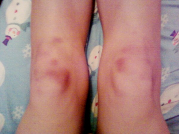 KHannonBall's tweet image. leopard knees! #guardproblems #guardprobz
