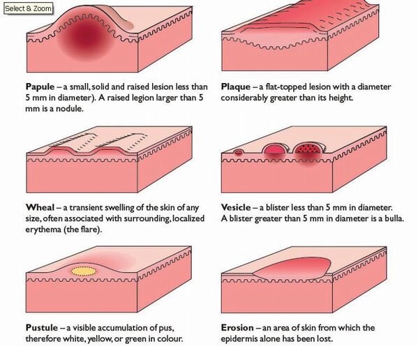 dermatological definition