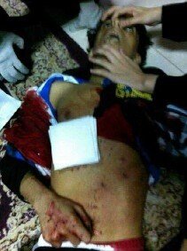 FreedomPrayers's tweet photo. Hussain Ali AlJazeery, shotgun victim, is only 14yrs old. “@NewsDaih:  http://t.co/komTn3yp” #Bahrain #FEB14