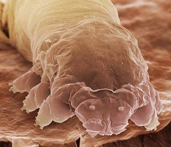 AlshehriEyeMD's tweet image. #معلومة_جديدة

 ينتقل هذا النوع من &quot;السوس&quot; الذي يعيش بين الرموش عن طريق مشاركة الماسكرا خصوصا في محلات التجميل !