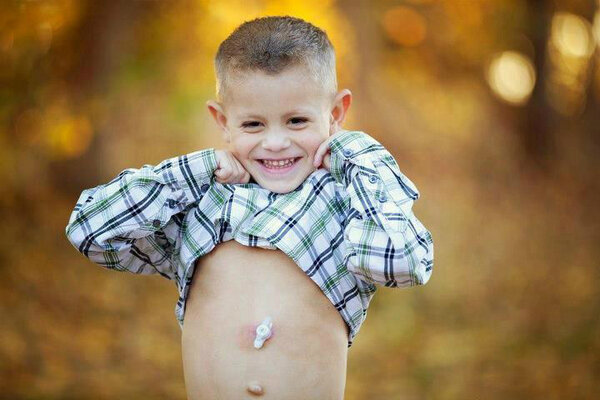 <a href="/MarielleJaffe/">Marielle McKamy</a> Can we get a RT for this precious boy? Imagine a life with NO FOOD! #carterswalk #feedingtubeawareness