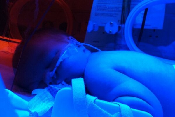 #feedingtubeawareness Finley had his nasal gastric tube from the very beginning until his peg at 11 months.