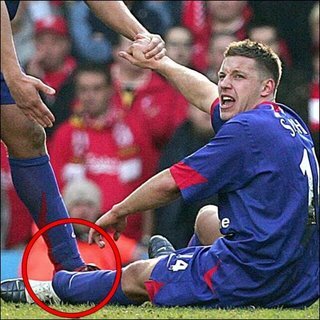 dederima's tweet image. Blonde #14RT @unitedarmyfc: ON THIS DAY | 2006 - Kaki Alan Smith patah saat pertandingan FA Cup v Liverpool.
