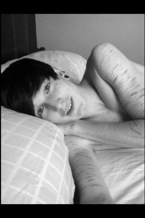 AVSTlN's tweet image. "@I_Hate_Society_: This boy is beautiful. RT if you think so too. http://t.co/9nwLskP7nT" scars don't make you any less beautiful.