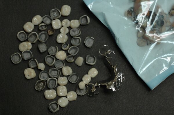 WindyStarDDS's tweet photo. Spring cleaning. Hope there will be metal refiners present @Chicago_Dental Midwinter Meeting this week. #CDS13 #MWM13 http://t.co/KR3bHtew
