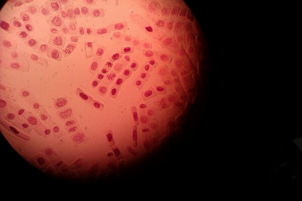 dbd_cancer's tweet image. “@MissSherezade: Mitosis hecha por @Nereida92 y yo :) #DeLibro :) http://t.co/moMic5Mb3e”q arte!!