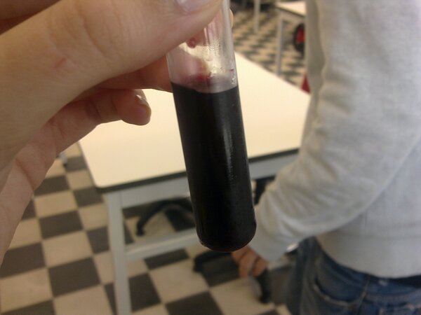 browniiesawyer's tweet image. is that blood? aha #labclass #yougottaloveit