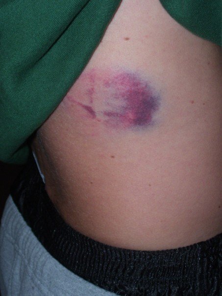 k__shaw21's tweet image. @VinnieP52 @Kbrock716 tried throwing me his knuckle ball one time....this is what happened. #collegeyears #Lscreen