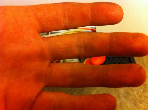 GaryFergz's tweet photo. @AllyGWang dirty and cut up hands. Question of the day. Where was that picture taken? And what am I doing in there? http://t.co/NQeVXn8T1P