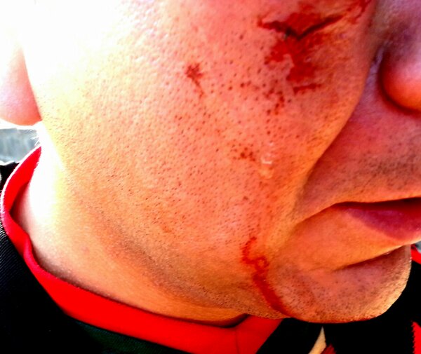 MORAF_20's tweet photo. Se armó la campal pero bárbara!! no puedo decir que con saldo blanco, pero todo bien!!! http://t.co/lCIn72L29d