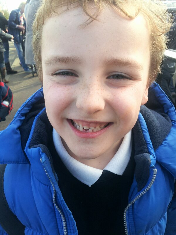 ferguspe's tweet photo. Ryan loses his first tooth! http://t.co/LU7Wusnn0W