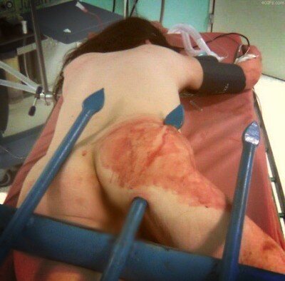 ABCDAAN's tweet image. Sws pijnlijk .