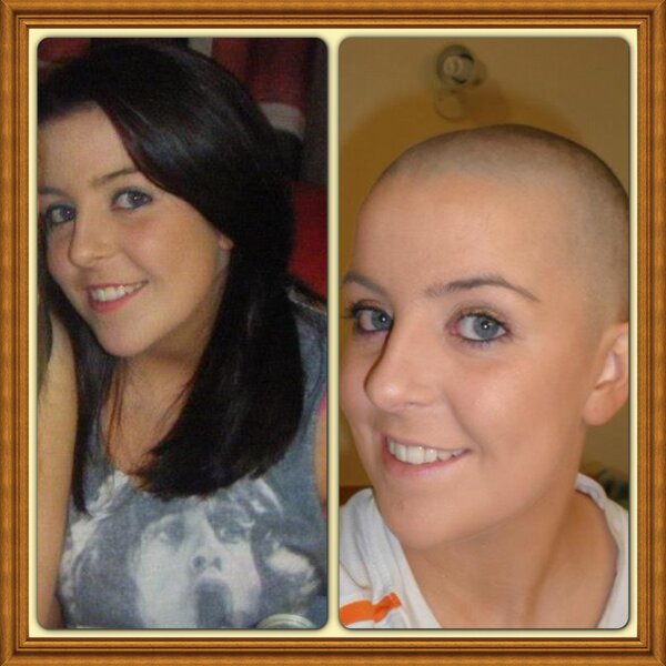 OGraxox's tweet photo. So proud !! Cousin shaved her head for cancer @ollyofficial  http://t.co/Ftk1qAynfV http://t.co/T8munwbul8