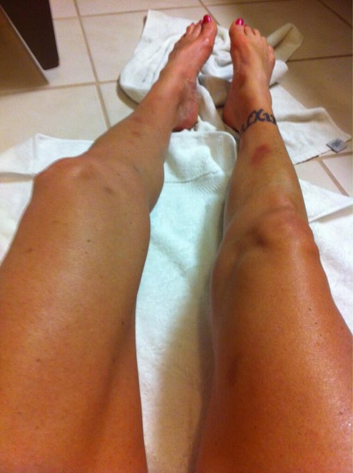 My legs tan and a few bruises http://t.co/gtH35ldTND<a href="/tag/xxx"class="tags"><span>#xxx</span></a><a href="/tag/milf"class="tags"><span>#milf</span></a><a href="/tag/trucks"class="tags"><span>#trucks</span></a><a href="/tag/sexinatruck"class="tags"><span>#sexinatruck</span></a>