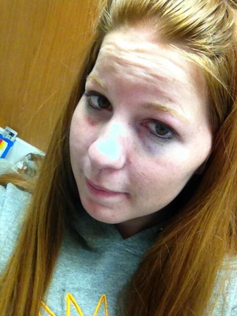 kels975's tweet image. Ain&apos;t my eye pretty! It hurts so bad! #colorguardproblems #rifleproblems
