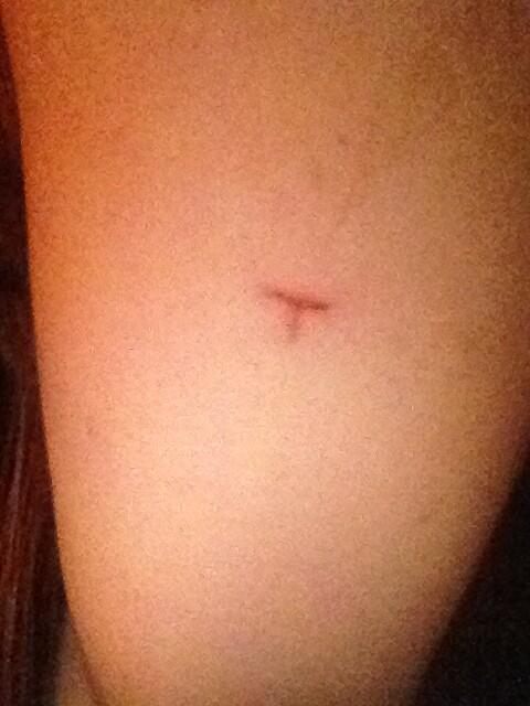 EllaMariaaa's tweet image. Hope it doesn't scar :( #Tfor..Ella?