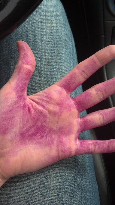 What happens when you forget to buy gloves and color your hair anyway. #mylittleponymurder http://t.<a href="/tag/mylittleponymurder"class="tags"><span>#mylittleponymurder</span></a>