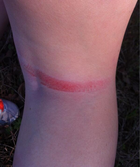 linz2011's tweet image. This is what happens when i get in the middle of your mom and Ginger! #closelined #baddog @RyanCasey9