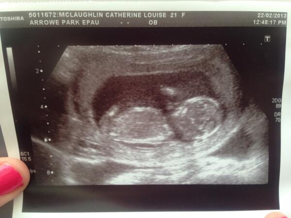 Cateym91's tweet photo. My baba<3 http://t.co/gGsGNiLZMl