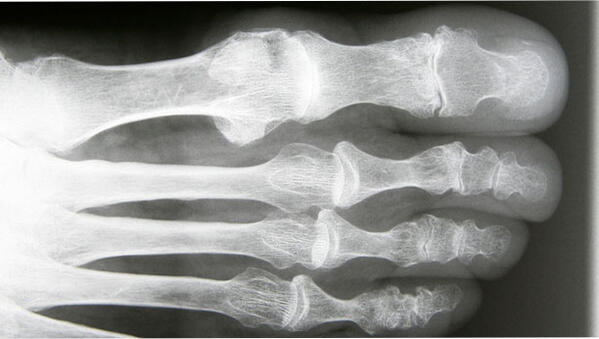 femicare tweet media