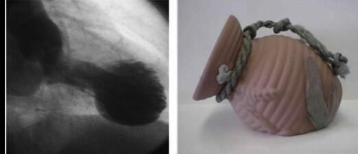 <a href="/HeartSisters/">Carolyn Thomas ☮️</a> <a href="/tbouthillet/">Tom Bouthillet</a> 
YES- you can break a woman's heart- we see about 5-6 a year.  Looks like an octopus pot