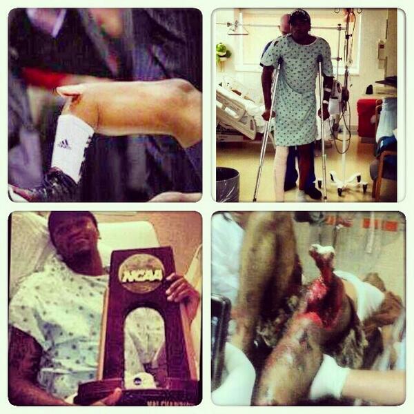Fizzy_M97's tweet image. #prayforware Respect to Kevin Ware @_billionairebev broke his leg on Sunday,walking on Monday.