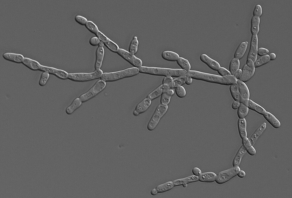 Дрожжеподобные грибы candida. Дрожжеподобные грибки Candida albicans. Candida albicans псевдомицелий. Candida albicans мицелий.