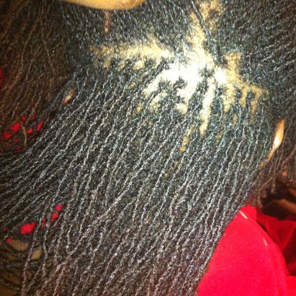 HuntressLocs's tweet image. DIY #Sisterlocks #retightening time. It's not so bad, but my arms hurt. I'm back to the ladies of @HairByMH in May.