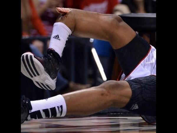 CammyRhodes's tweet image. Oh my god it looked bad in the video but this... #prayforware