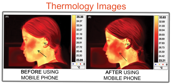 Radblock's tweet image. Thermal images taken after mobile phone use #radblock