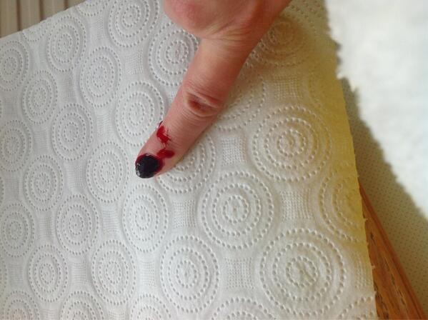 itssophiefisher's tweet image. Ouch :( #diyproblems