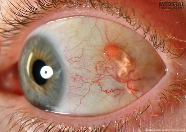 medical photography