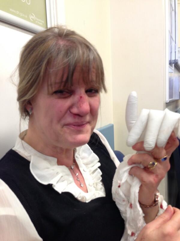 FuzzyLogicDance's tweet image. My first day off in months and I get to go to A and E, mums done a carol vordamon....thanks mum, bless ya