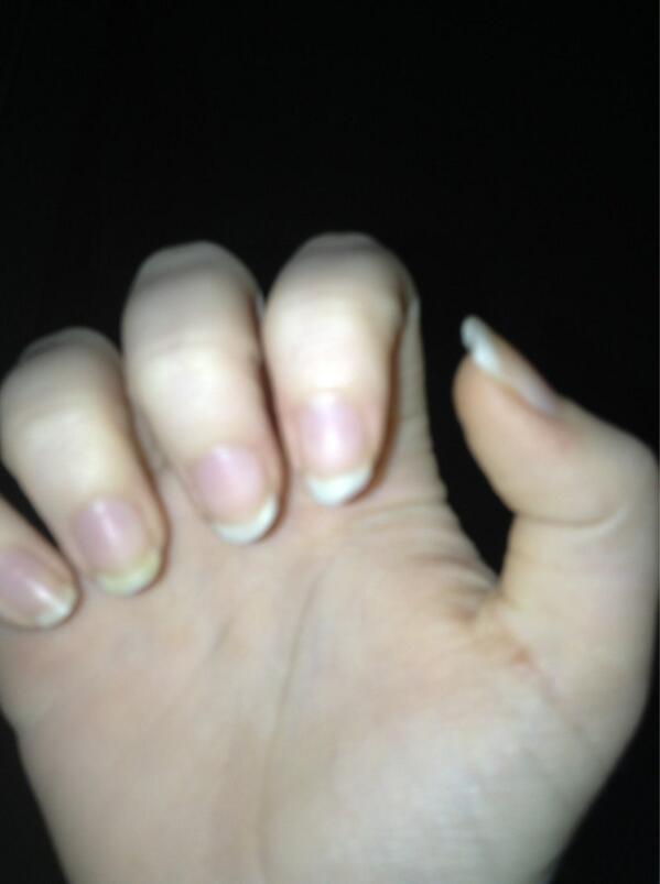 CheckmateJailed's tweet image. 